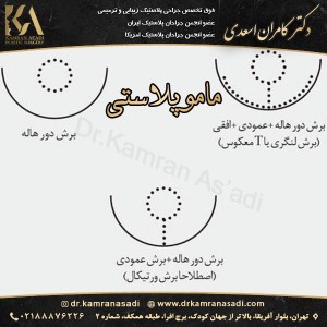 ماموپلاستی - دکتر کامران اسعدی