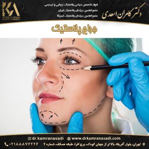جراح پلاستیک تهران_دکتر اسعدی